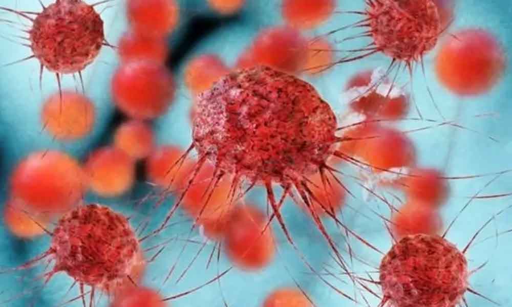 ক্যান্সারের বড় অংশই প্রতিরোধযোগ্য