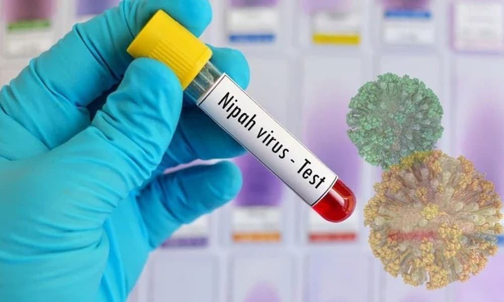 দেশে নিপাহ ভাইরাসে এক নারীর মৃত্যু, সতর্কবার্তা বিশ্ব স্বাস্থ্য সংস্থার
